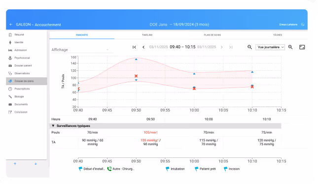 Galeon care record showing a patient's blood pressure and pulse curves with time-stamped routine monitoring